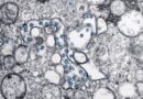 Brote de Ciclospora en Estados Unidos afecta más de mil 600 ciudadanos. pic-CDCpexels-The Border Reports