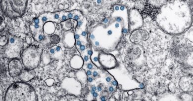 Brote de ciclosporiasis en Estados Unidos, más de 1,600 casos y miles por confirmar Brote de Ciclospora en Estados Unidos afecta más de mil 600 ciudadanos. pic-CDCpexels-The Border Reports