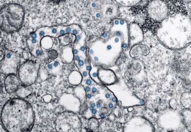 Brote de Ciclospora en Estados Unidos afecta más de mil 600 ciudadanos. pic-CDCpexels-The Border Reports