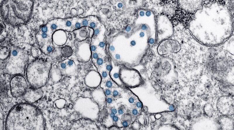 Brote de Ciclospora en Estados Unidos afecta más de mil 600 ciudadanos. pic-CDCpexels-The Border Reports