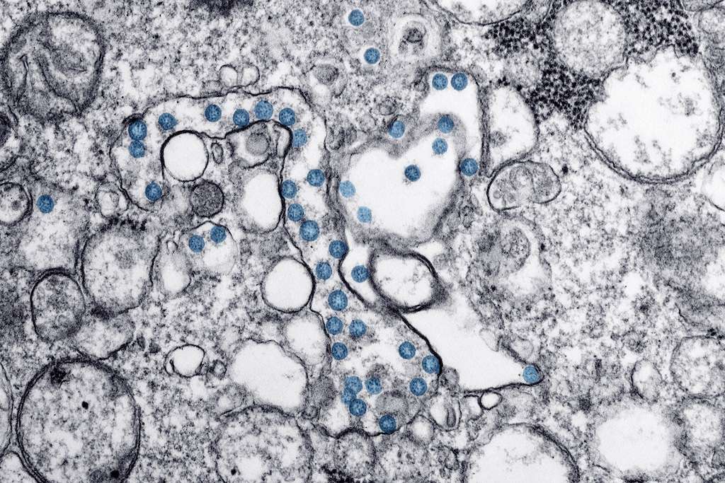 Brote de Ciclospora en Estados Unidos afecta más de mil 600 ciudadanos. pic-CDCpexels-The Border Reports